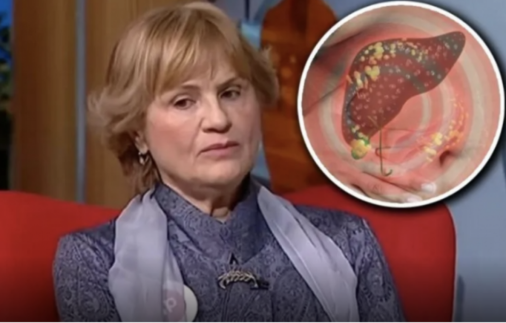 DOKTORKA RADMILA OTKILA KOJE SU NAJBOLJE NAMIRNICE ZA MASNU JETRU: Ono što je rekla o SURUTKI, mnoge će Š0KIRATI