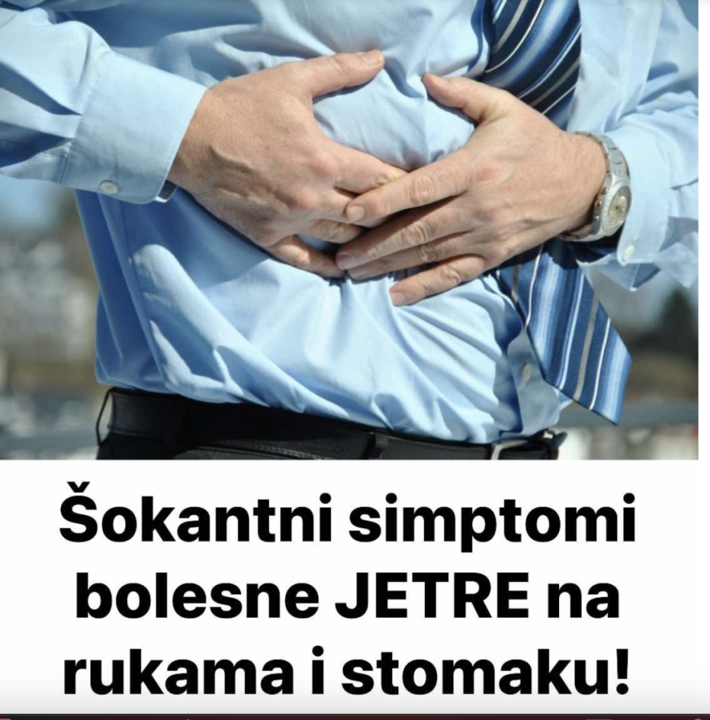 Šokantni simptomi bolesne JETRE na rukama i stomaku!