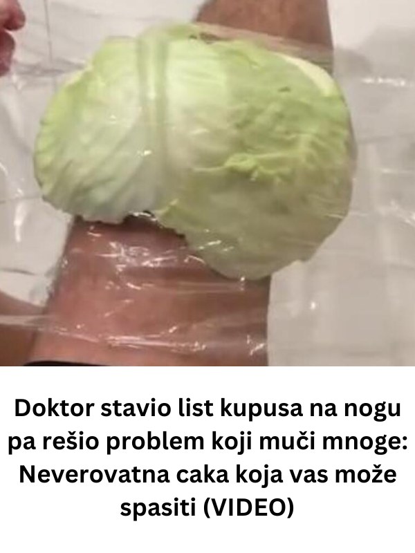 Doktor stavio list kupusa na nogu pa rešio problem koji muči mnoge: Neverovatna caka koja vas može spasiti