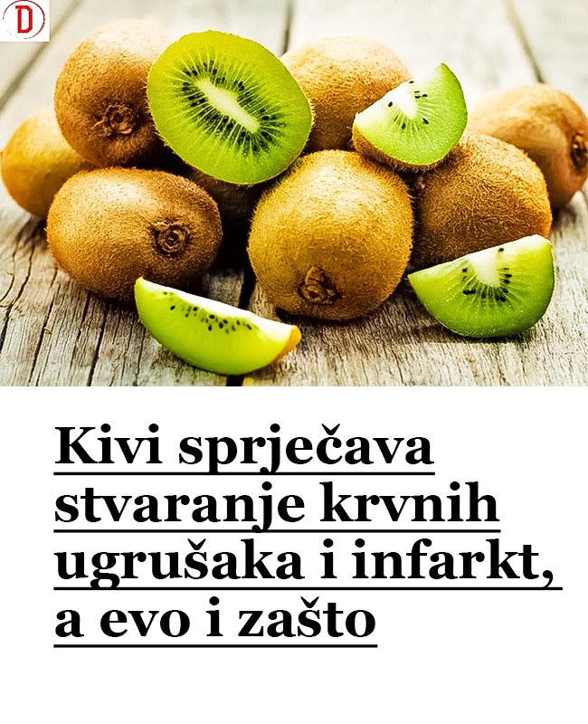 Kivi sprječava stvaranje krvnih ugrušaka i infarkt, a evo i zašto