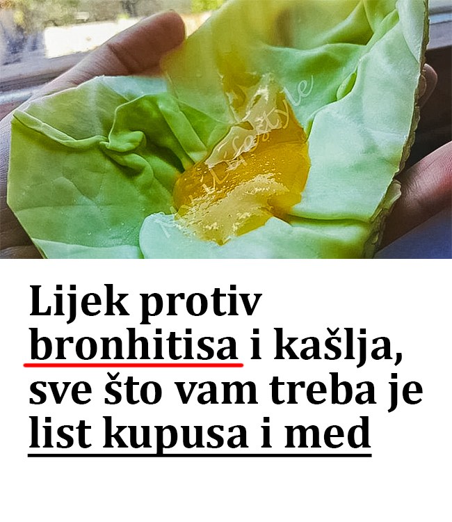 Lijek protiv bronhitisa i kašlja, sve što vam treba je list kupusa i med