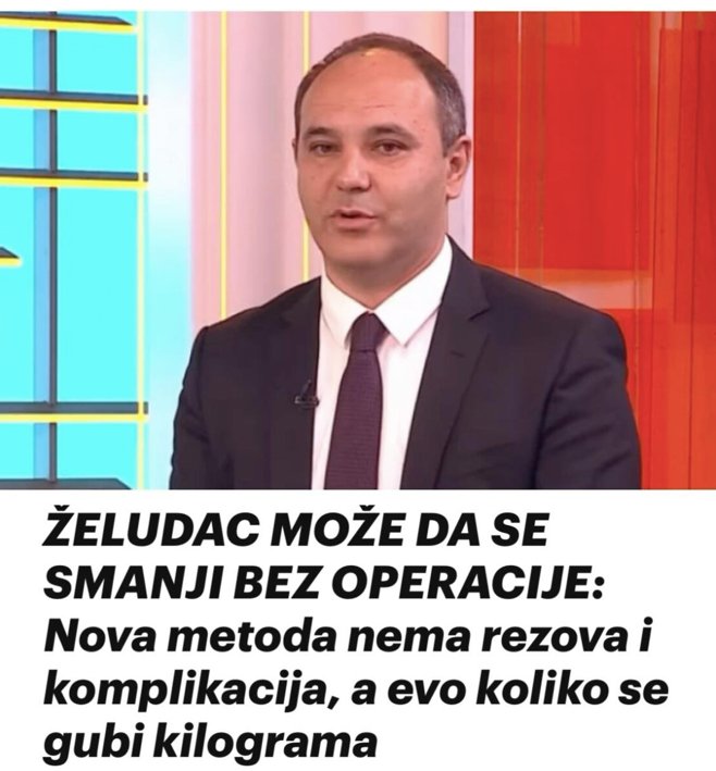 ŽELUDAC MOŽE DA SE SMANJI BEZ OPERACIJE: Nova metoda nema rezova i komplikacija, a evo koliko se gubi kilograma