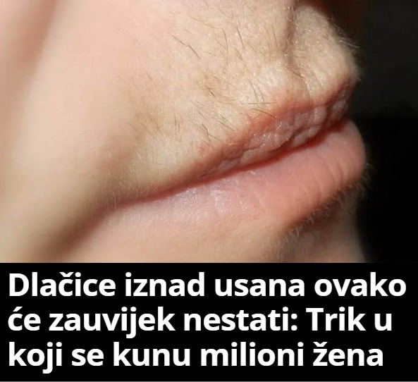 Dlačice iznad usana ovako će zauvijek nestati: Trik u koji se kunu milioni žena